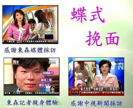 糸で脱毛する新式の糸除毛